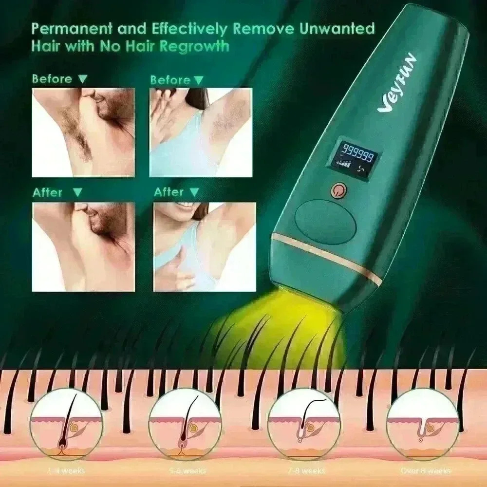 IPL Hair Removal, VEYFUN Hair Removal for Women with 5 Intensity Levels Save $50 - Picture 11 of 13
